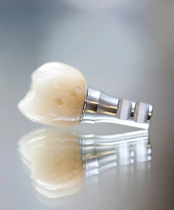 A single dental implant with its crown
